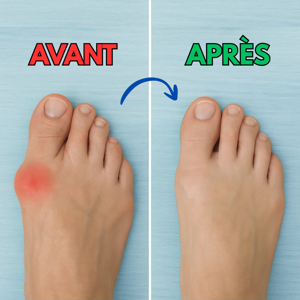 Semelles Péi - Soulagez vos pieds dès aujourd’hui, sans rendez-vous ni médicament