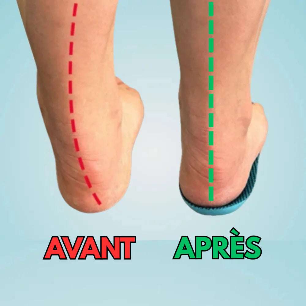 Semelles Péi - Soulagez vos pieds dès aujourd’hui, sans rendez-vous ni médicament