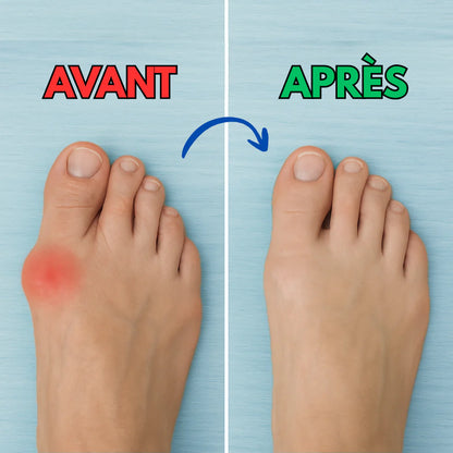 Semelles Péi - Soulagez vos pieds dès aujourd’hui, sans rendez-vous ni médicament