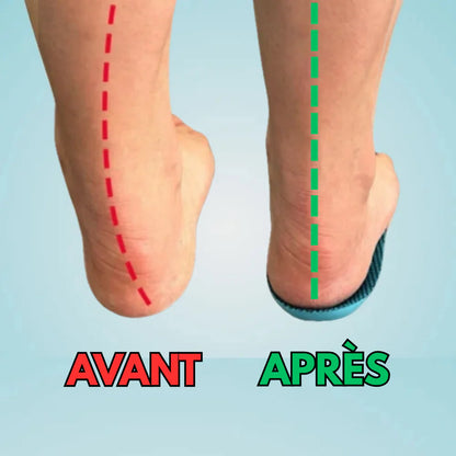Semelles Péi - Soulagez vos pieds dès aujourd’hui, sans rendez-vous ni médicament